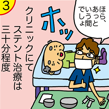 尿道ステント治療イメージ