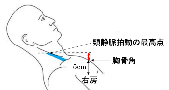図2 頸静脈の診察