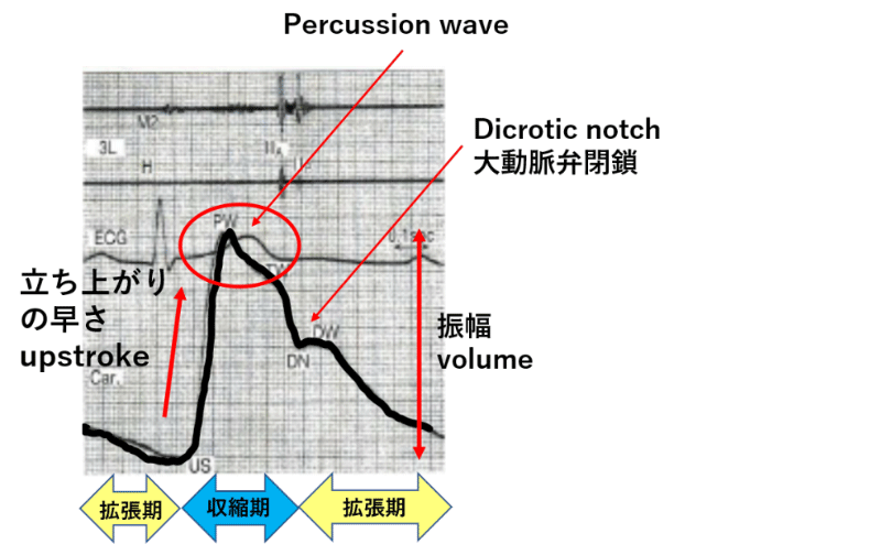 図3 正常の頸動脈波形(若年)