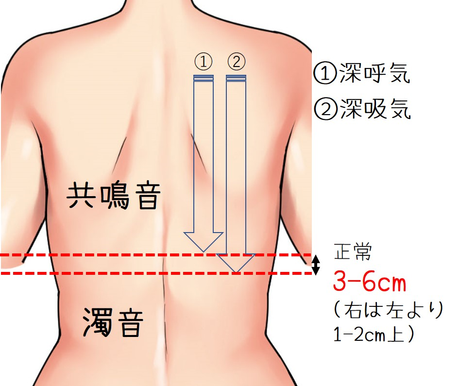 打診イメージ