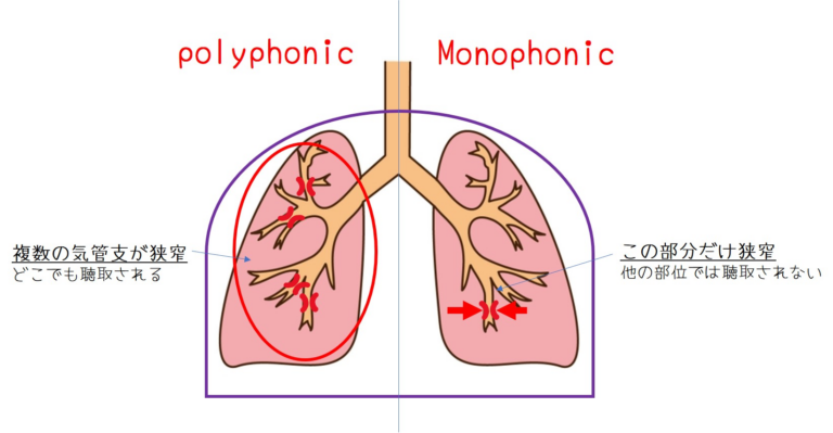 イメージ：単音性(monophonic)と多音性(polyphonic)