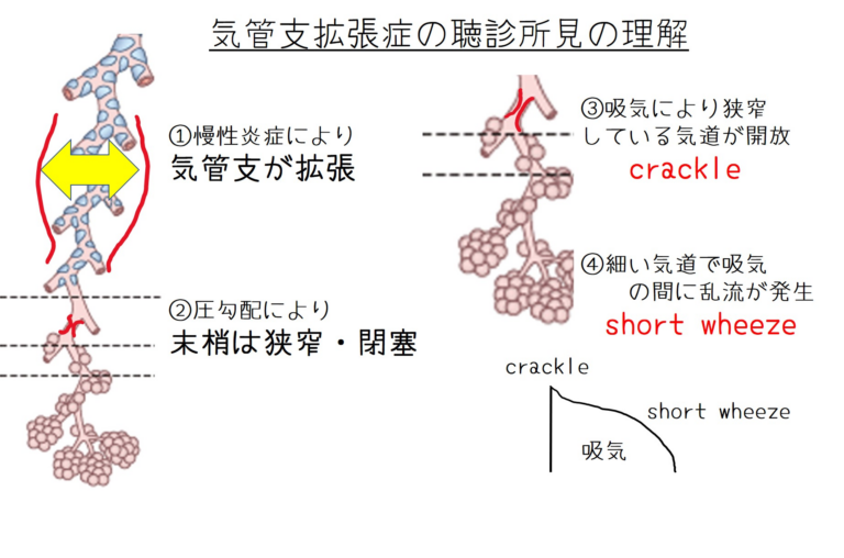 イメージ：squawk解剖学的理解