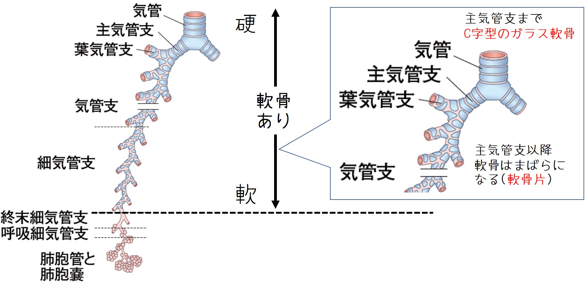 イメージ：rhonchiとwheezesから気道狭窄の部位と病態を予測