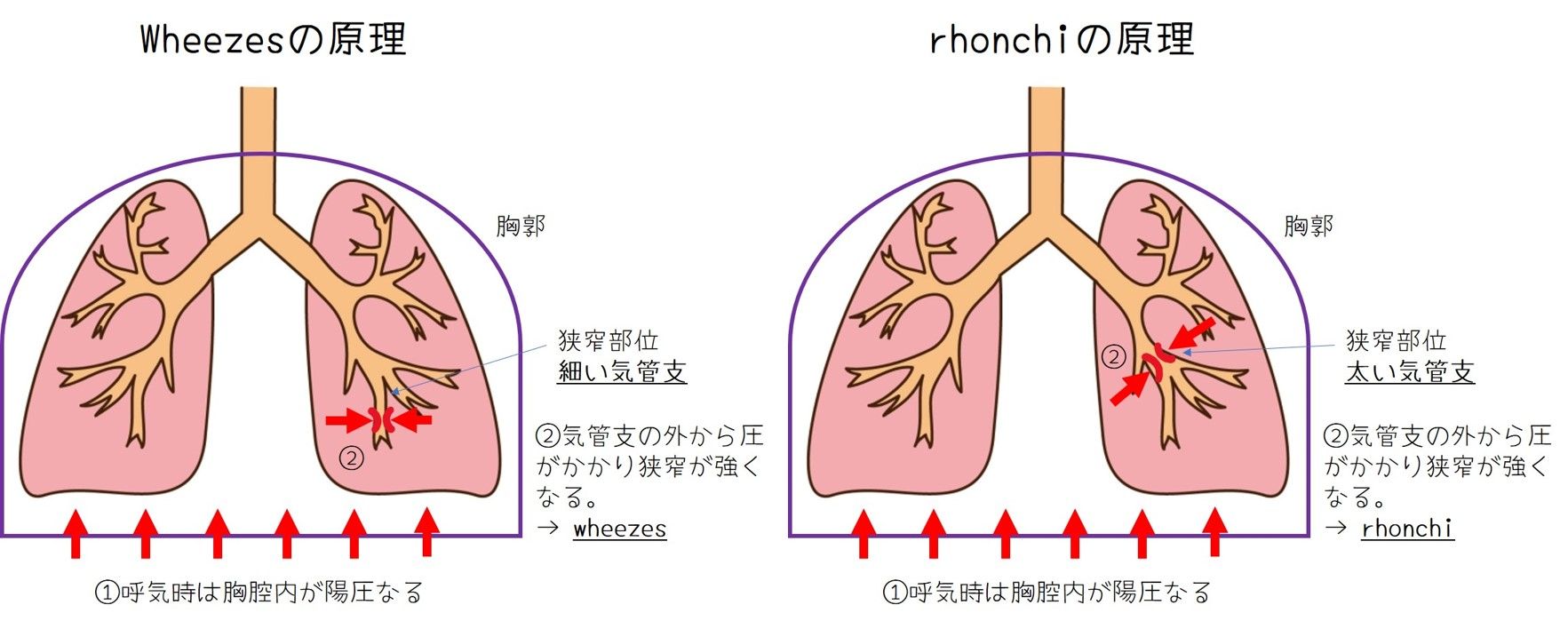 イメージ：rhonchiとwheezesから気道狭窄の部位と病態を予測