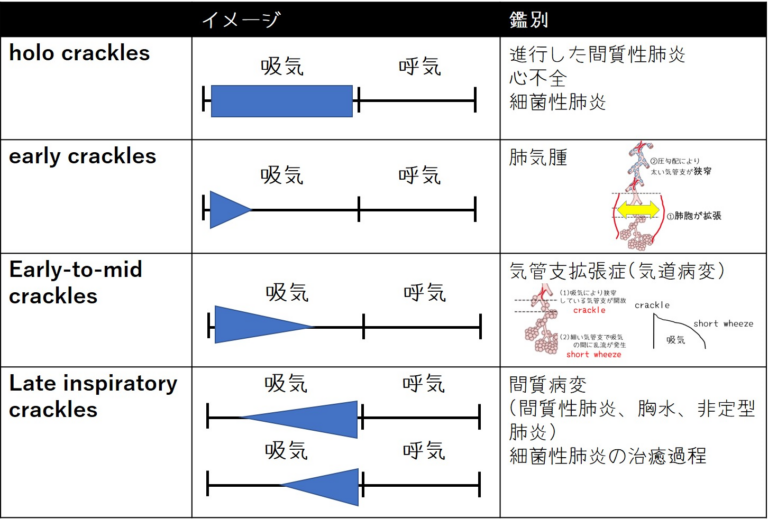 呼吸相を意識して改善を判定する・参考イメージ