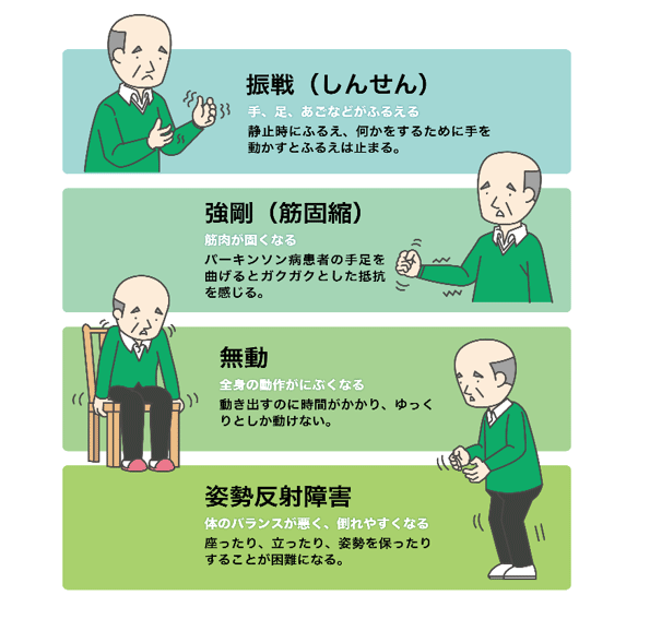 パーキンソン病の症状