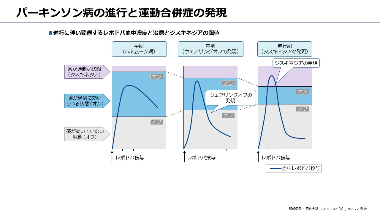 パーキンソン病の進行と運動合併症の発現