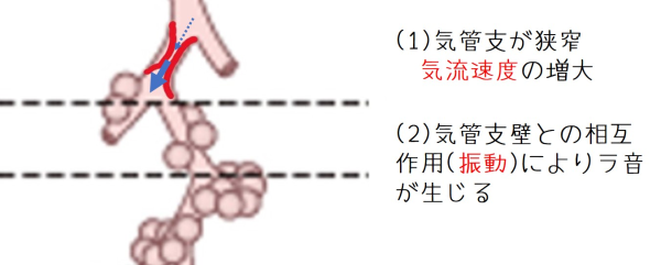 イメージ：連続性ラ音の発生機序