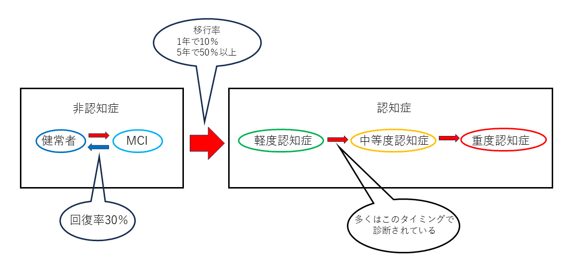 軽度認知症、「MCI」について